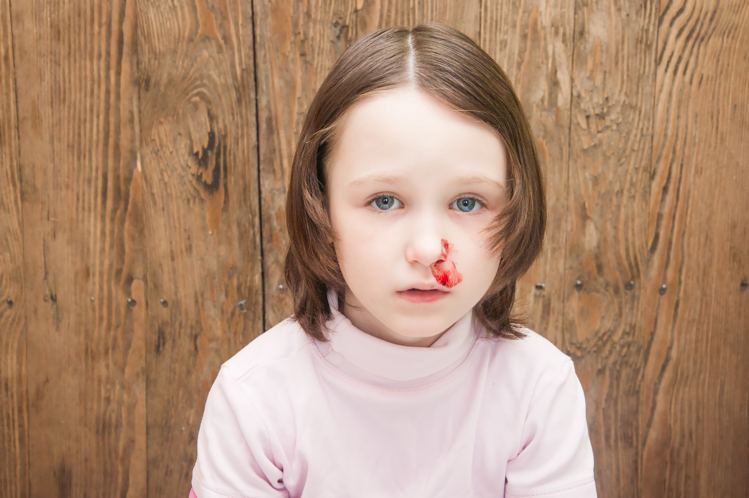 first aid steps for bleeding nose in children