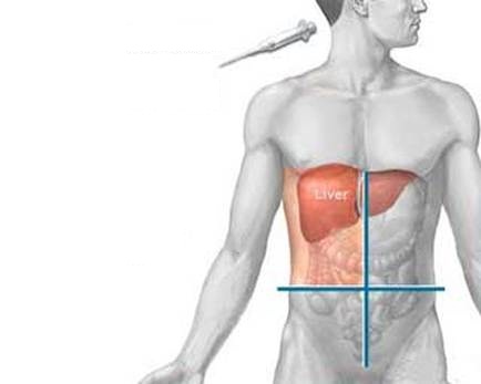 symptoms of hepatitis b